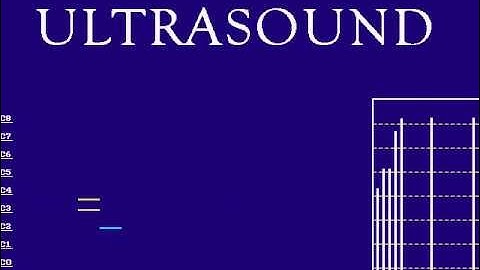 Doom2 music - level 9 played on Gravis Ultrasound