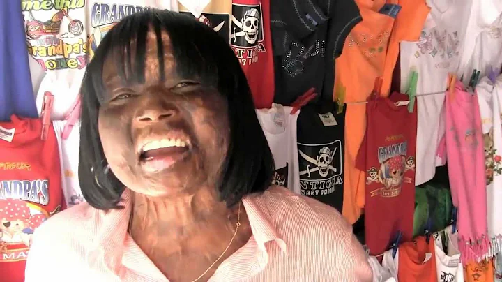 Burn Survivor, Paula Jacobs - Love & Thanks to Bri...
