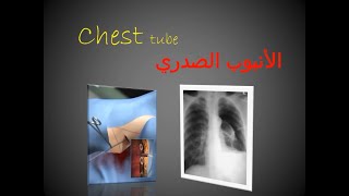 Chest tube/ الأنبوب الصدري كيف أفعل