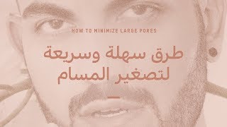 اسباب وعلاج المسام الواسعة 👃🏻 غلق مسامات الوجه ✋🏻 ازالة والتخلص من الرؤوس السوداء