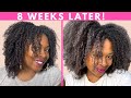 MSM for Hair Growth| Hair Growth Challenge- 8 Week Update