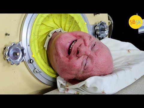 The Man in an Iron Lung (A Polio Survivor&#39;s Story)