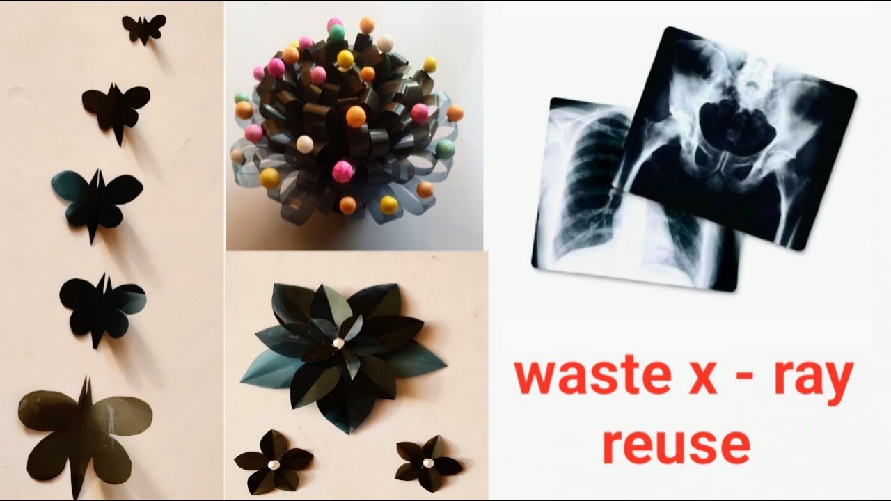 DIY Waste xRay Reuse Ideas Best Out Of Waste Home Decor Ideas