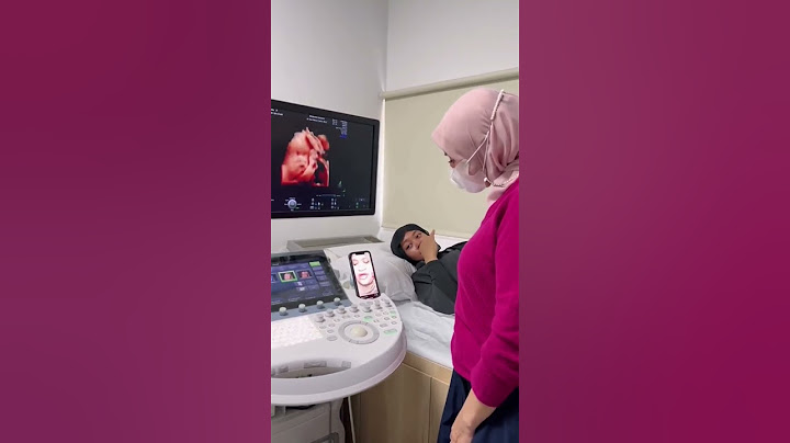 Rehan Keluar Ku Rehan😳😳
