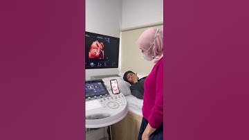 Thumbnail of Rehan Keluar Ku Rehan😳😳