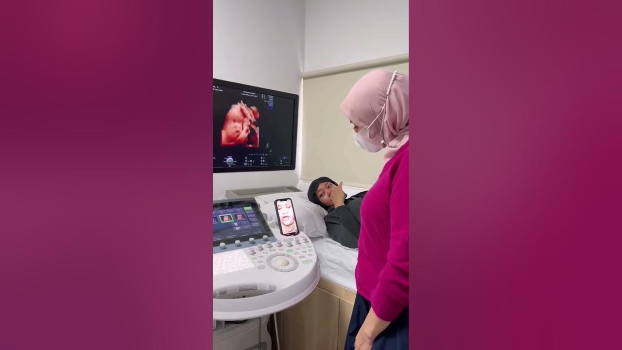 Rehan Keluar Ku Rehan😳😳