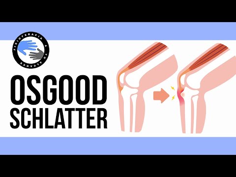 Vídeo: Com reduir el dolor de la malaltia d’Osgood Schlatters: 11 passos