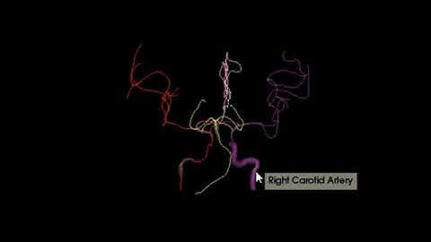 Automated workflow for brain vessel analysis