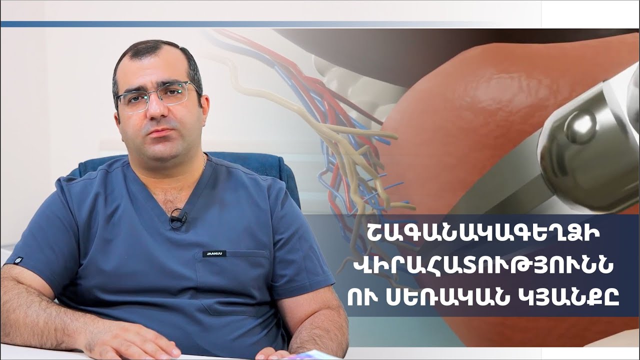 Շագանակագեղձի քաղցկեղ․ վիրահատությունից հետո սեռական ֆունկցիան պահպանվո՞ւմ է | MedForum