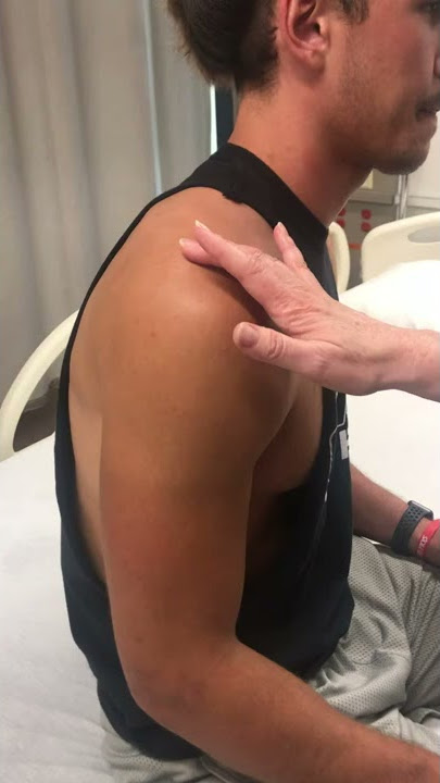 Deltoid muscle identification