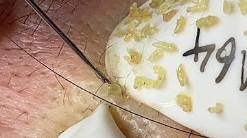 Satisfying With Loan Nguyen Spa Video #035