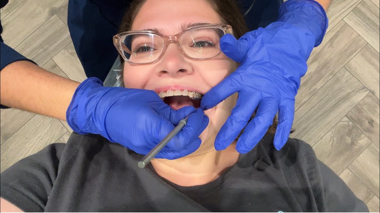 [4K] 7/8 Months Braces Update! #braces #Invisalign #orthodontics - YouTube