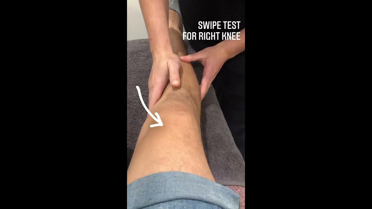 This Test Is Used In The Clinic To Assess For A Knee Effusion Or Swelling Joint