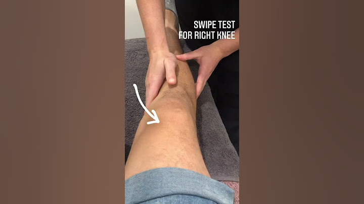 This test is used in the clinic to assess for a knee effusion, or swelling in the knee joint