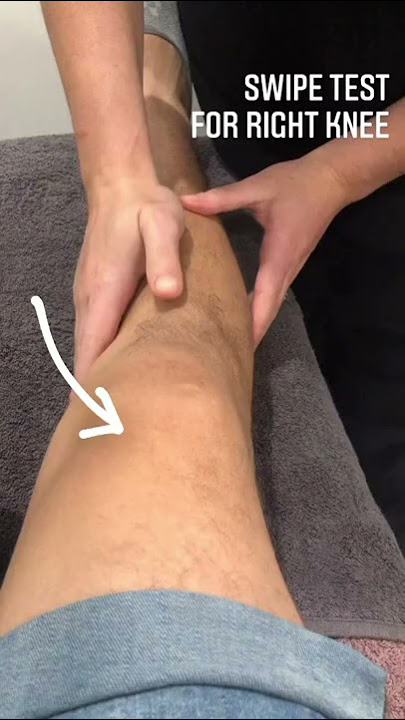 This test is used in the clinic to assess for a knee effusion, or swelling in the knee joint