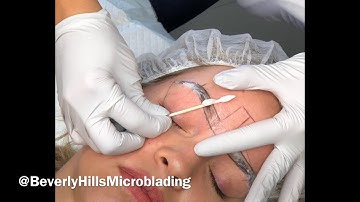 Removing numbing cream without smudging your microblading eyebrow pre draw.