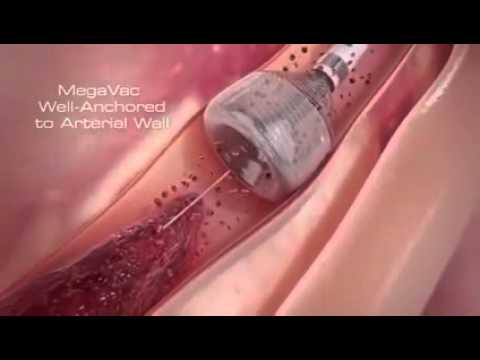 New technology in medical field