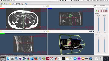 FISICO Fast Image SegmentatIon COrrection