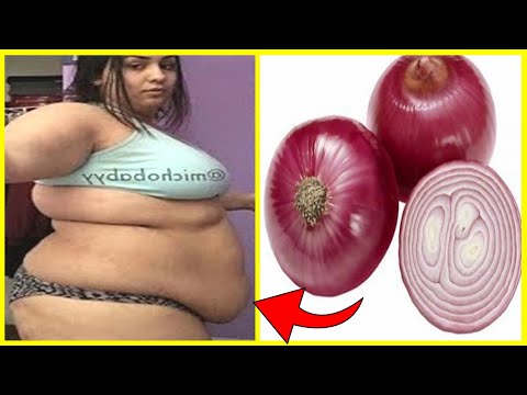 How I Lost Belly Fat In 7 Days With Onion : No Strict Diet No Workout!