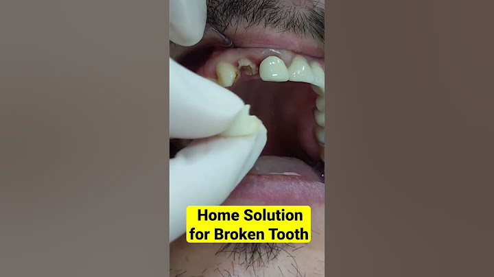 Quick Home Solution for Broken Tooth #shorts
