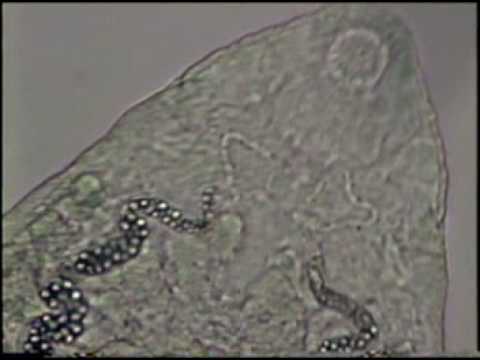 cercaria - echinostome