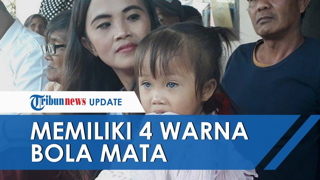 Viral Bocah 2 Tahun Miliki 4 Warna Mata Yang Berubah Ubah Sang Ibu Sempat Kira Anaknya Buta Youtube