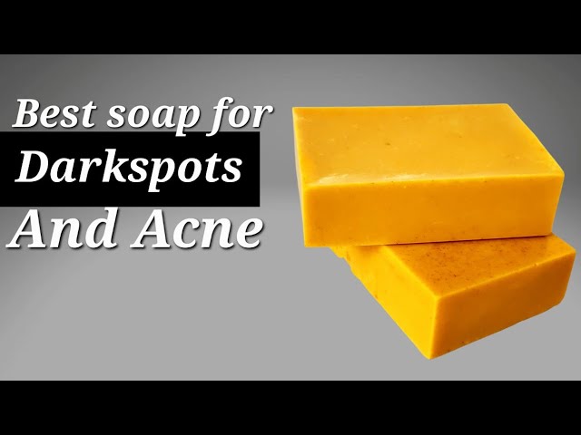 Homemade Goat Milk Soap for Acne-Free and Supple Skin - Dr. Axe