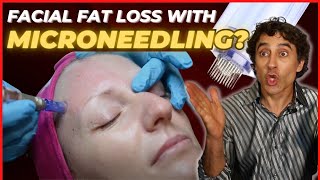 WILL MICRONEEDLING CAUSE YOUR FACIAL FAT LOSS and DAMAGE YOUR SKIN