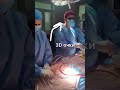 Полностью 3D-эндоскопическая пластика дефекта межпредсердной перегородки у пациента 18 лет