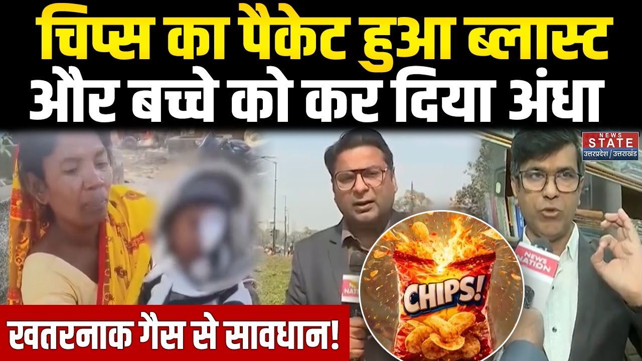 Chips Packet Gas Blast: अचानक फटा चिप्स का पैकेट...और बच्चे को कर दिया अंधा | Nitrogen Gas