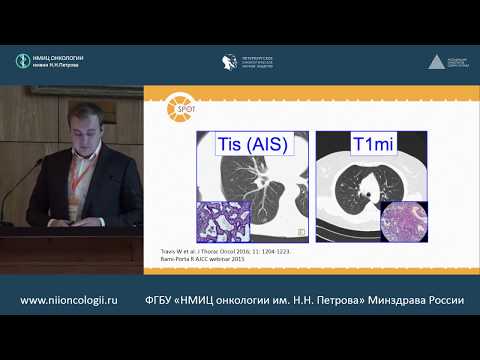 Видео: Многооконные КТ на основе рентгеновских сигнатур при дифференциации индолентного и агрессивного рака легких в национальном исследовании по скринингу легких: ретроспективное исследо