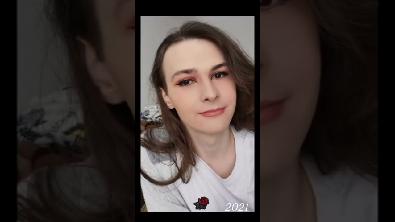 MTF HRT TRANSITION TIMELINE -7 |TRANSWOMAN| TRANSGENDER