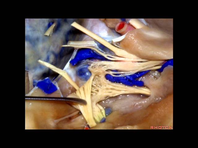 Cavernous Sinus and Middle Fossa - Part 1 of 2