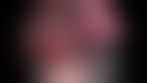 Uniportal VATS left lower dorsal and posteroabasal anatomic segmentectomy S6-10