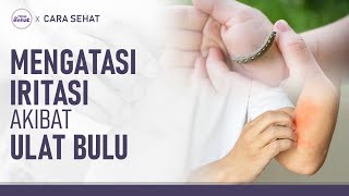 Cara Mengatasi Kulit Merah dan Gatal Akibat Ulat Bulu | Hidup Sehat tvOne