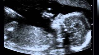 GSM 19 Weeks-3