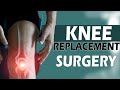 Total Knee Replacement Surgery | DR VijayBhaskar | Health And Beauty