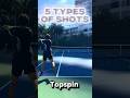 5 Types of Shots