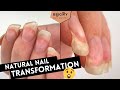 Unbelievable Transformation On NATURAL Nails 😱