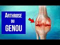 Soigner l'arthrose du genou : Les traitements