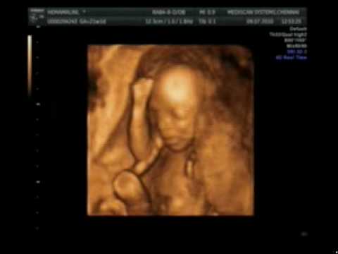 4 months baby in womb