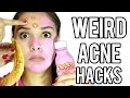 10 WEIRD Acne & Zit Hacks that work FAST!