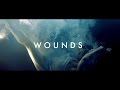 Ulysse  wounds official