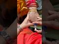 Cannulation To Obese People Cannulation To Obese People