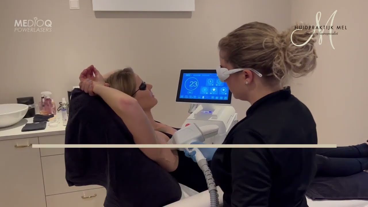 Diode ICE power laser ontharen bij Huidpraktijk Mel