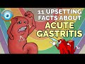 11 upsetting facts about acute gastritis step 1 comlex nclex pance aanp
