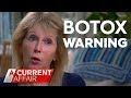 Botched Botox Warning | A Current Affair