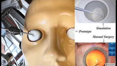 A New Parallel Remote-Centre-of-Motion Robot for Eye Surgery