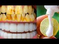 सिर्फ 2 मिनट में गंदे दांतों को मोती की तरह चमका देगा यह घरेलू नुस्खा Teeth Whitening Remedy