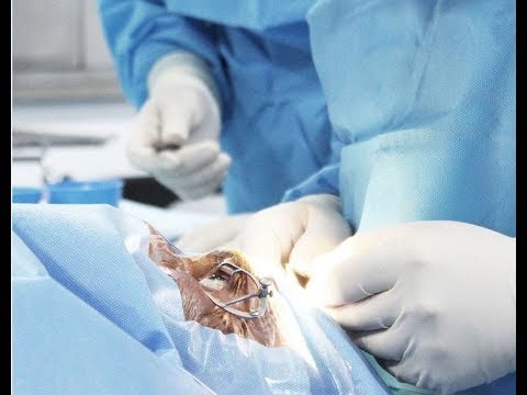 القصة الكاملة ل قرنية القصر العيني مي ت ناقص